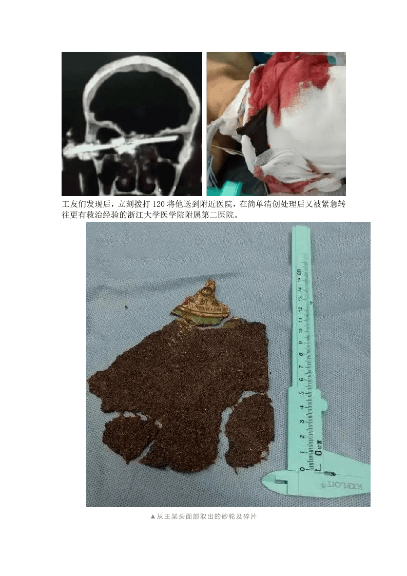 砂轮机事故案例.docx 第2页